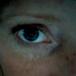 FreckleSmanatha